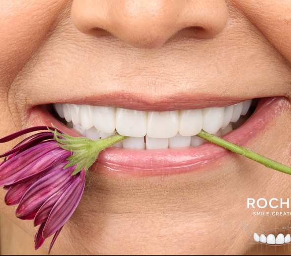 Aplicación clínica dental con flor